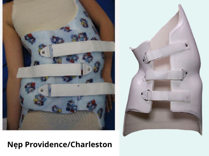 Nẹp Providence Và Charleston