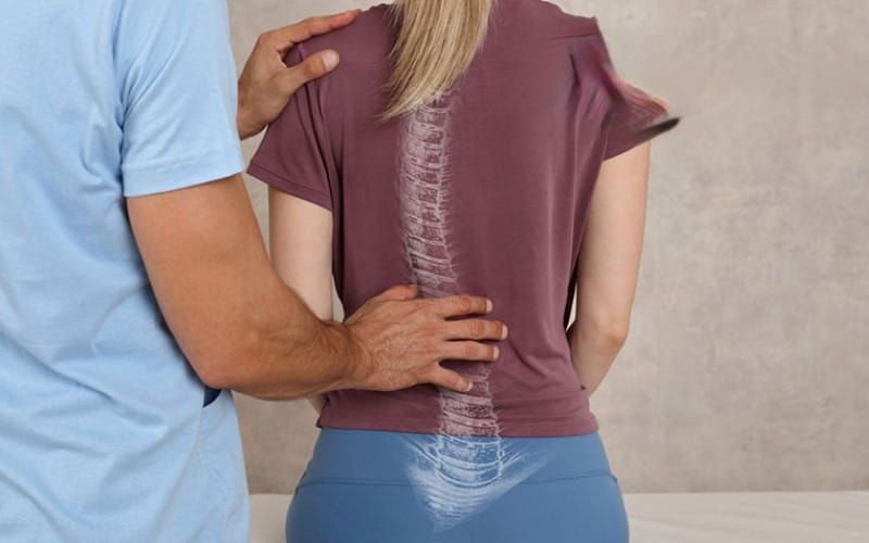 Cách Chữa Vẹo Cột Sống Ở Người Lớn Theo Từng Mức Độ Cong Vẹo