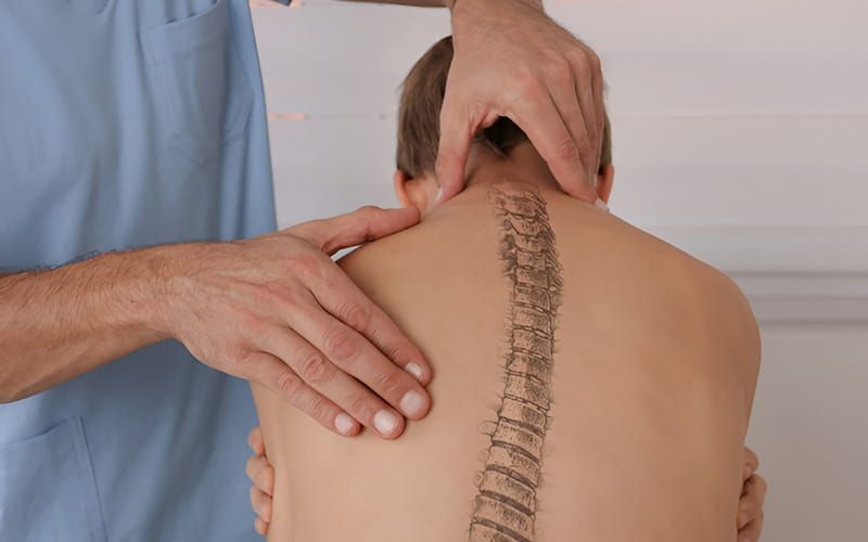 Vì sao điều trị cong vẹo cột sống cần tìm nguyên nhân gốc rễ?