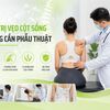 Điều Trị Vẹo Cột Sống Không Phẫu Thuật | Bones and Beyond