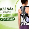 Khi Nào Cần Đeo Nẹp Chỉnh Hình Cột Sống? Chỉ Định Từ Chuyên Gia