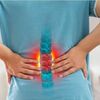 Vẹo Cột Sống 30 Độ Có Nguy Hiểm Không? Điều Trị Ra Sao?