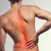 Vẹo Cột Sống 50 Độ: Có Nguy Hiểm, Có Cần Mổ Không?