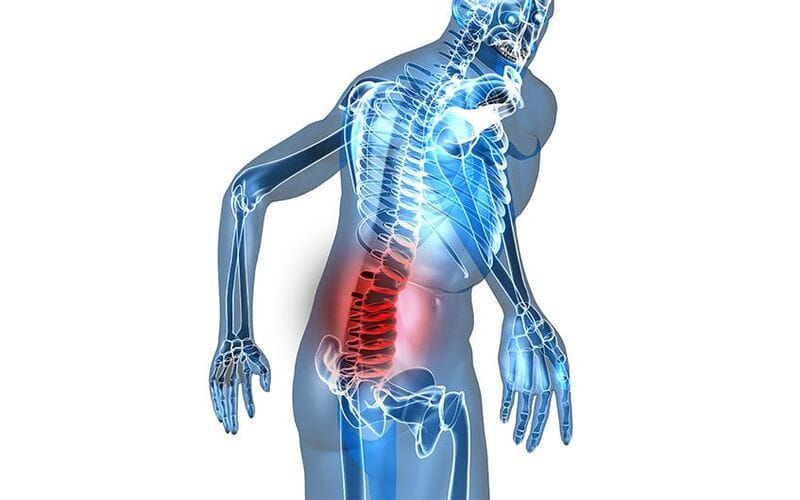 Đau Lưng Không Đứng Thẳng Được: Nguyên Nhân Và Cách Khắc Phục Hiệu Quả
