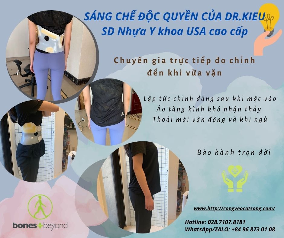 Mang đai vẹo cột sống - Phương pháp chữa cong vẹo cột sống an toàn và hiệu quả