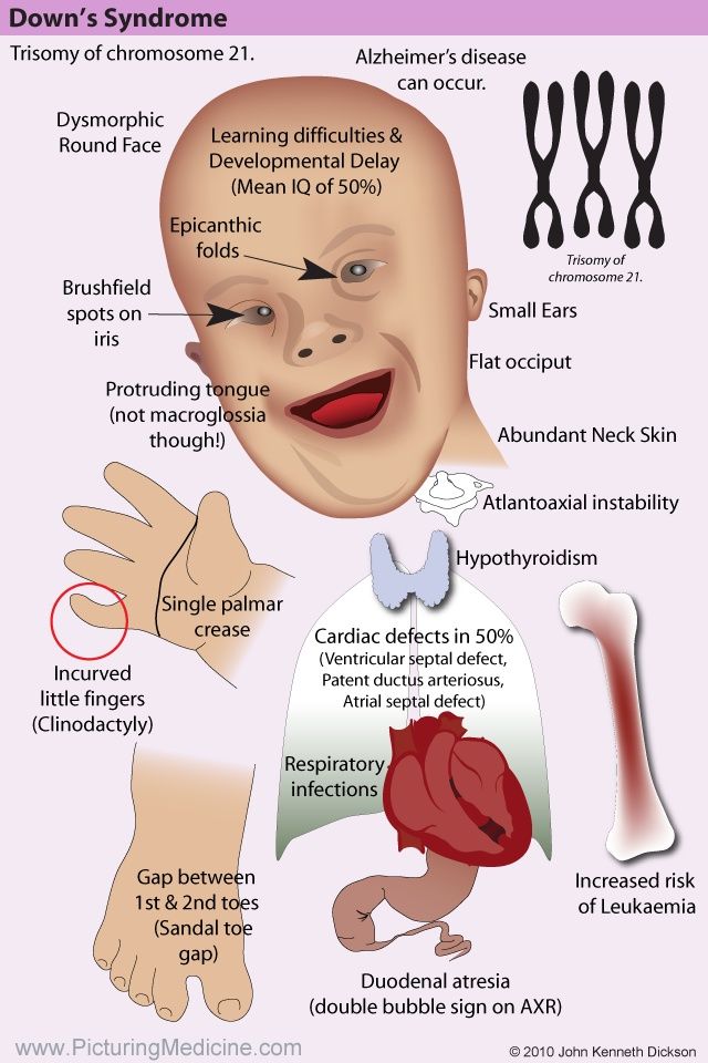 picturing-medicine-_--syndromes-1