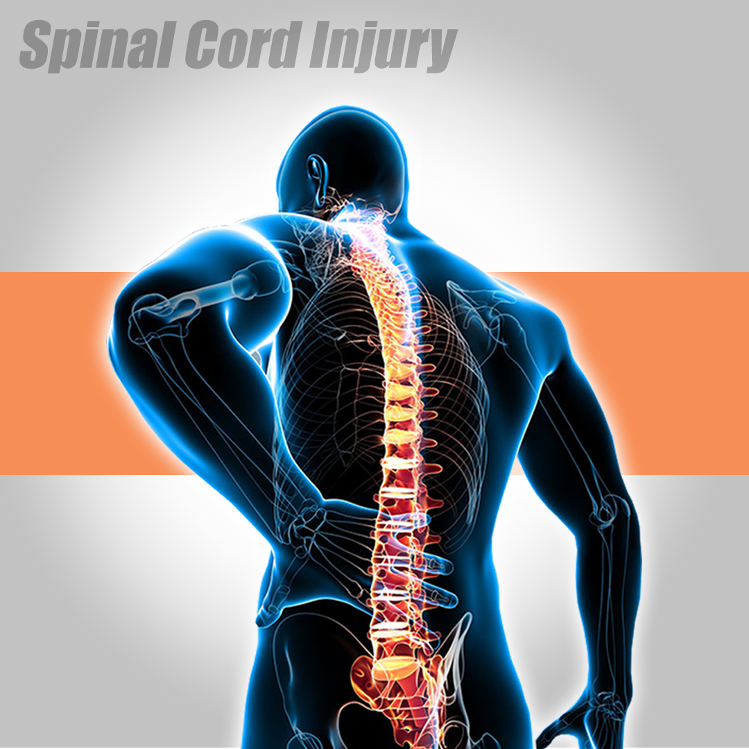 spinal-cord-injury