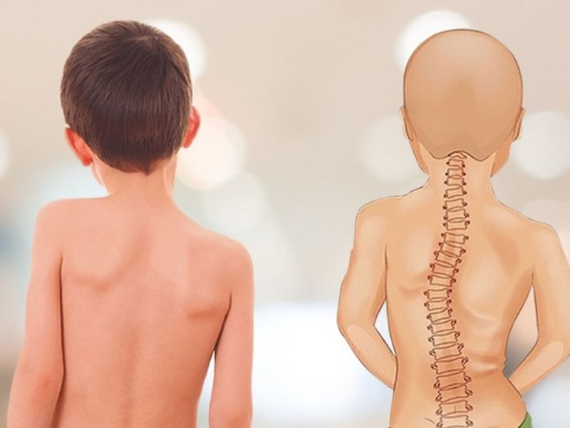 Kiểm Tra Sự Cân Đối Của Vai Và Hông