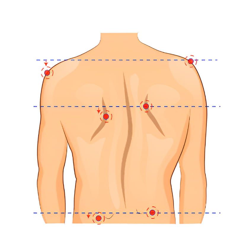 Triệu Chứng Cong Vẹo Cột Sống: Dấu Hiệu Nhận Biết Sớm Và Cách Phát Hiện