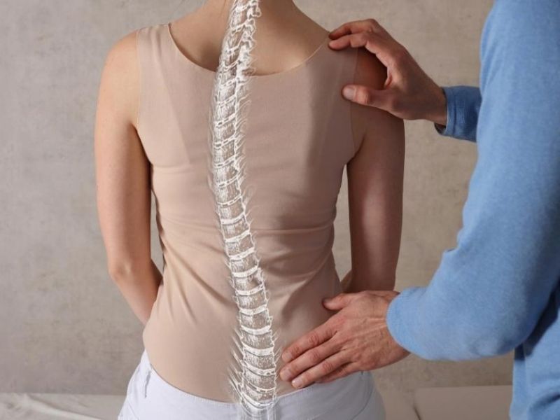 Vẹo Cột Sống 15 Độ Là Gì?