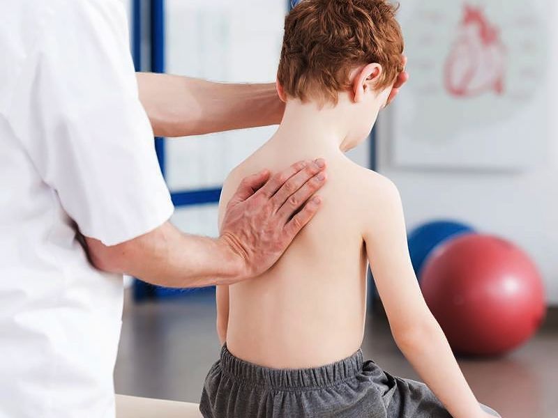 Vẹo Cột Sống 20 Độ Là Gì? Thuộc Mức Độ Nặng Hay Nhẹ?