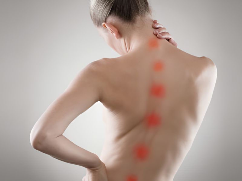 Vẹo Cột Sống 40 Độ Là Gì? Thuộc Mức Độ Nào?