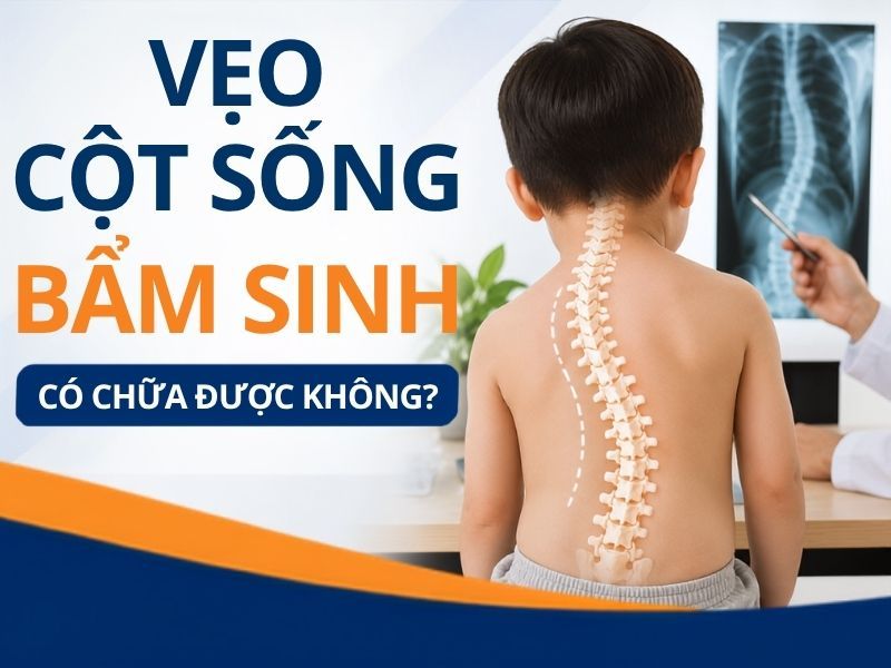 Vẹo Cột Sống Bẩm Sinh Có Chữa Được Không?
